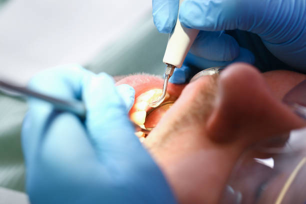 Best Emergency Root Canal Treatment in Newport, WA