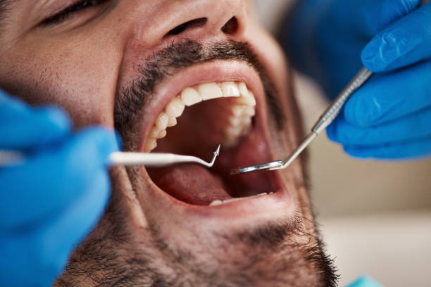 Best Emergency Dental Care for Broken or Chipped Teeth in Newport, WA