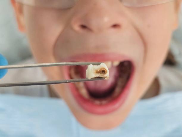 Best Emergency Gum Treatment in Newport, WA